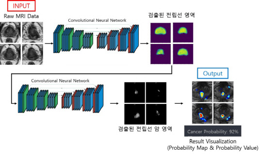 전립선암 영상 진단보조 소프트웨어 'JPC-01K'. 제이엘케이 제공